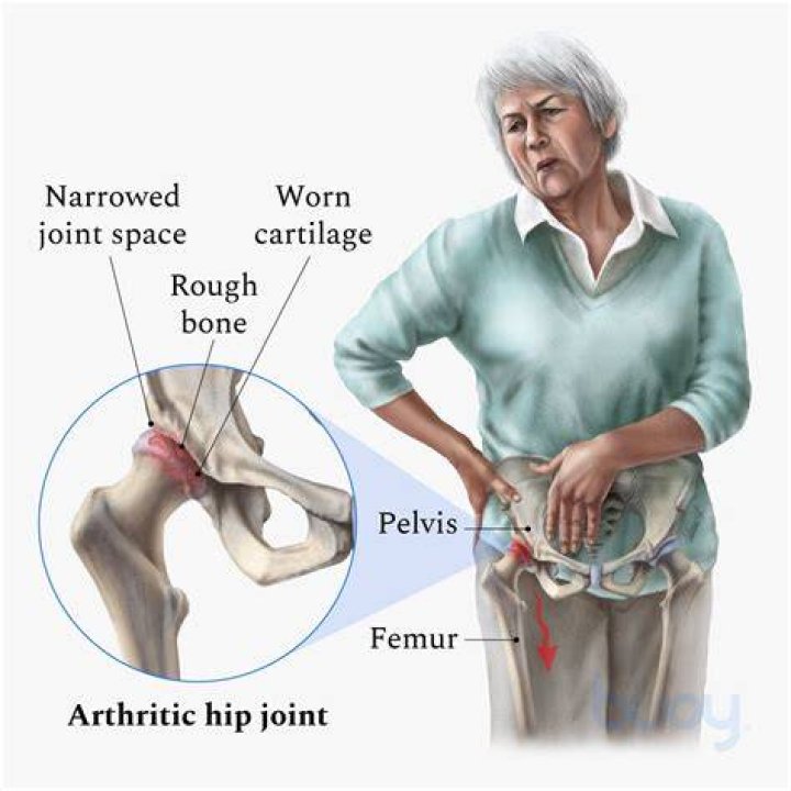 Why do my hip bones hurt so much?