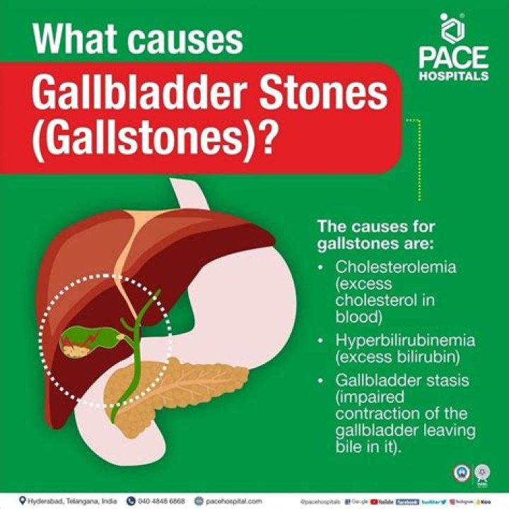 Why gallbladder stones happens?