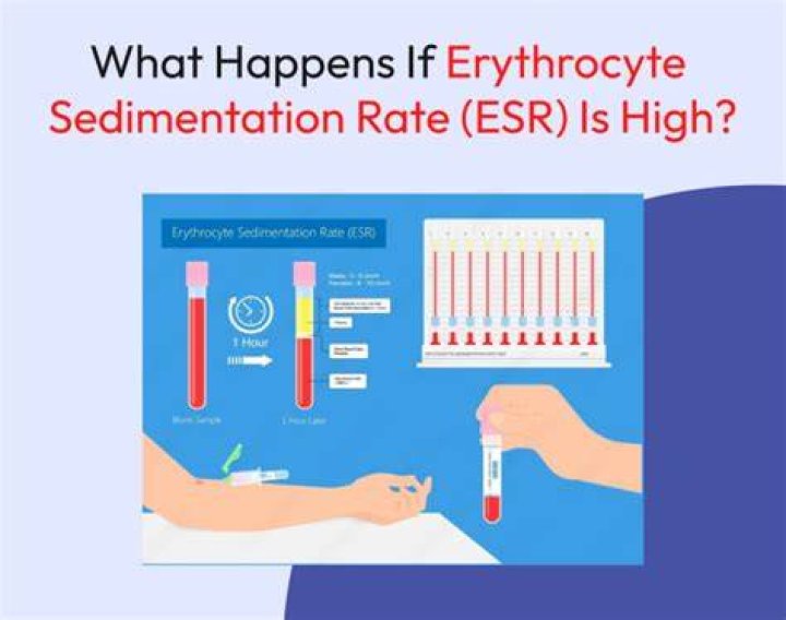 Why measure erythrocyte sedimentation rate?